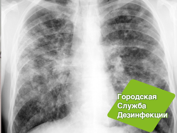 Качественная дезинфекция помещение при туберкулезе